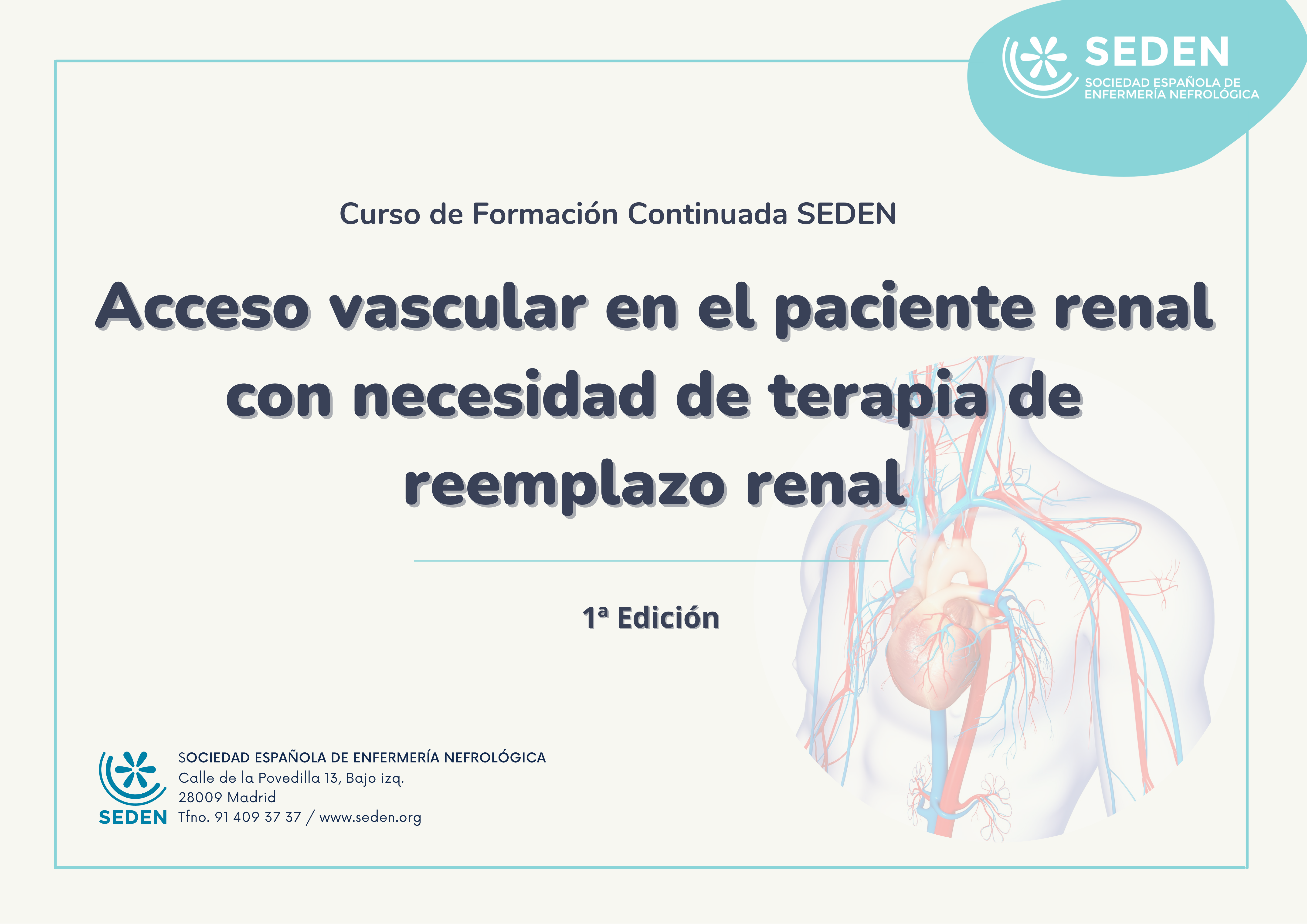 Acceso Vascular en el paciente renal con necesidad de terapia de reemplazo renal. 1ª edición