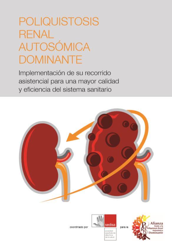 POLIQUISTOSIS RENAL AUTOSÓMICA DOMINANTE