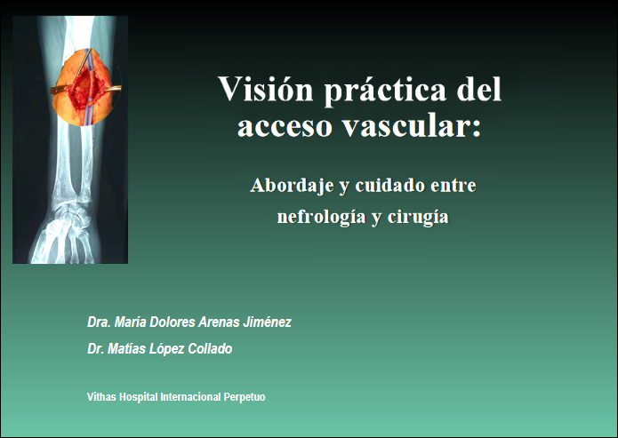 Visión Práctica del acceso vascular: abordaje y cuidado entre nefrología y cirugía